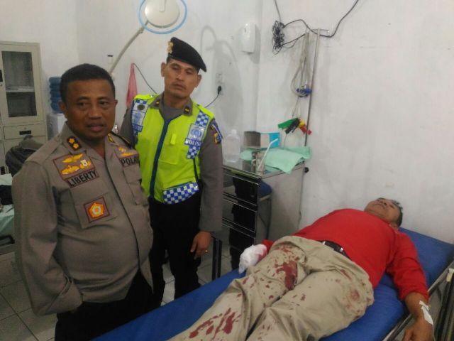 Rayakan Tahun Baru di Parapat, Seorang PNS Bernama Naibaho Kena Ledakan Kembang Api yang Dibakarnya