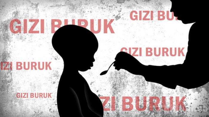 Terkait Gizi Buruk, Pemerintah Tak Boleh Saling Menuding Kesalahan