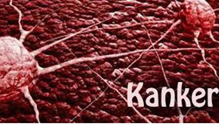 20 Kasus Penderita Kanker Ditemukan di Medan Setiap Bulan