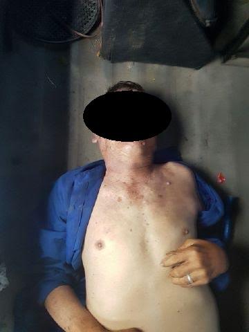 Baru Naik Angkot dari Medan Mall, Oen A Poh Sesak Nafas dan Meninggal