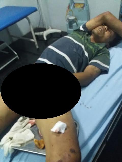 Melawan, Pelaku Curanmor Ditembak Petugas Sat Reskrim Polres Deli Serdang