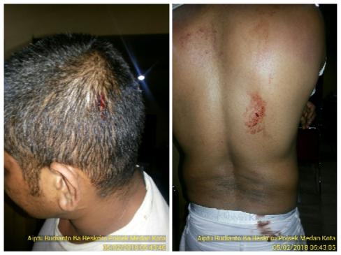 Saksi Bentrok di Diskotik New Zone Diperiksa Polisi