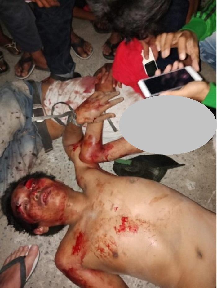 Dua Maling Nyaris Tewas Dihajar Massa di Bajak V Amplas