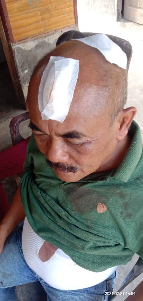 Diserang Puluhan Preman, Dua Anggota Presidium GM FKPPI Kena Bacokan