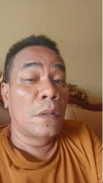 Pengelola UMKM di Medan Johor Laporkan Penganiayaan yang Dialaminya