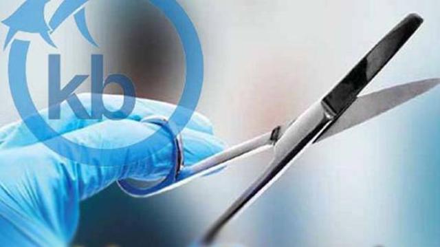 Diharamkan, Dokter Dilarang MUI Lakukan Vasektomi dan Tubektomi