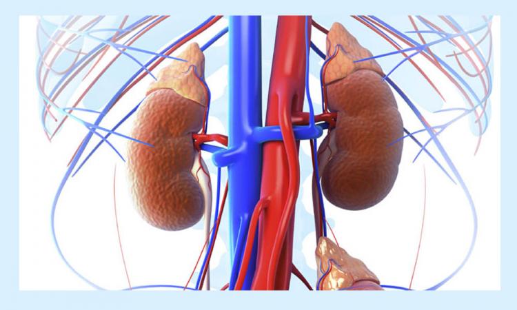 Waspadai Dua Penyakit Ini, Karena Mampu Jadi Pemicu Utama Rusaknya Ginjal