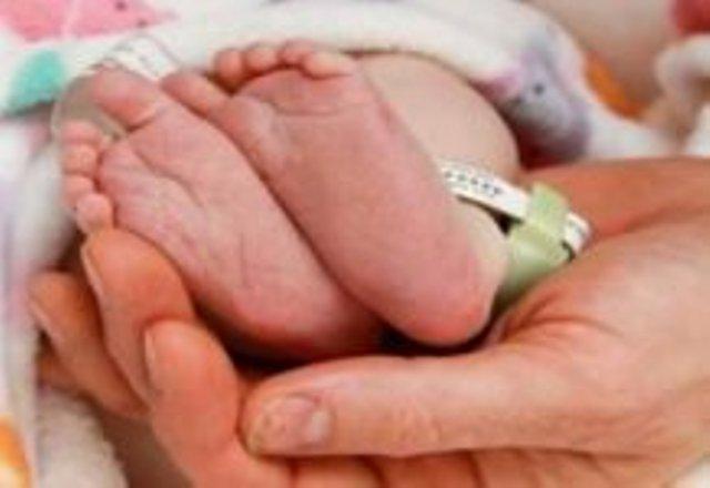 Innalillahi, Bayi dengan Usus Keluar Asal Labuhanbatu Meninggal di RSUP H Adam Malik