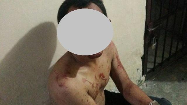 Gagal Rampas Sepeda Motor, Perampok Bonyok Dihajar Massa di Batang Kuis
