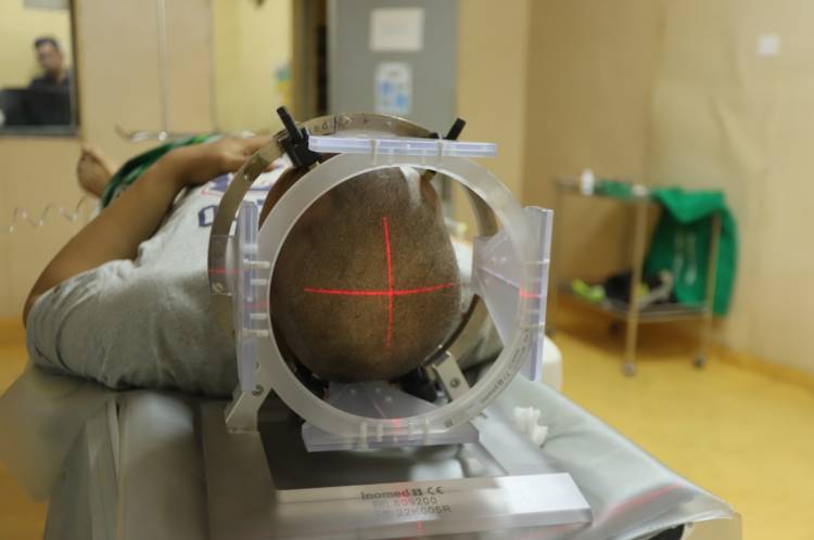 RSUP HAM Berhasil Lakukan Operasi Stereotaktik Tumor Biopsi Perdana