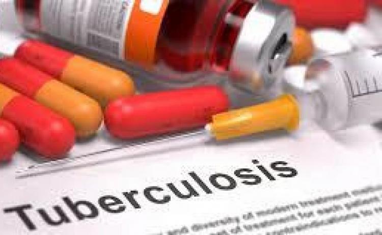 Penyakit Tuberkulosis Baru Bisa Teratasi di Tahun 2030