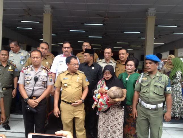 Biaya Dibantu Walikota Binjai, Gilang Aditya Penderita Hydrosefalus Akan Dioperasi di Malaysia