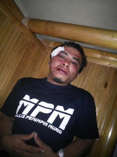 Pelaku Curanmor di Selesai Babak Belur Diamuk Massa