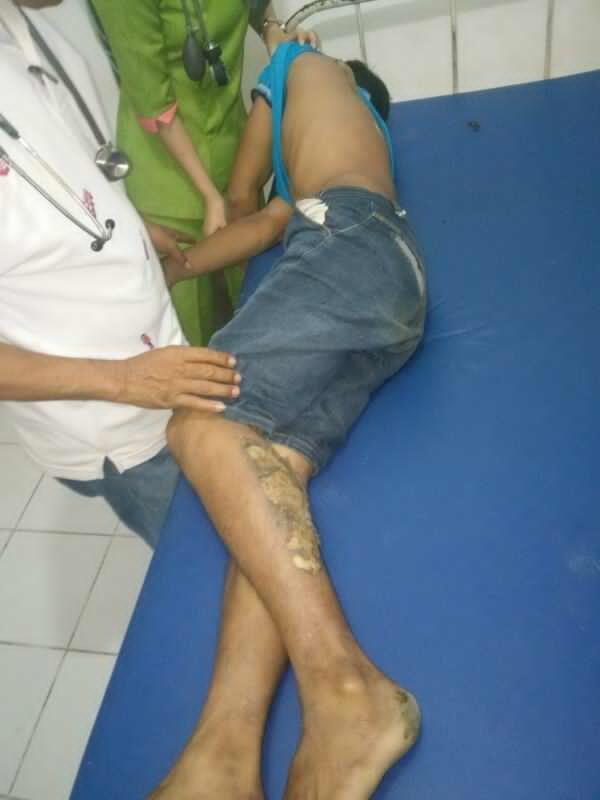 Penggerek Sawit Tewas Kesetrum Listrik