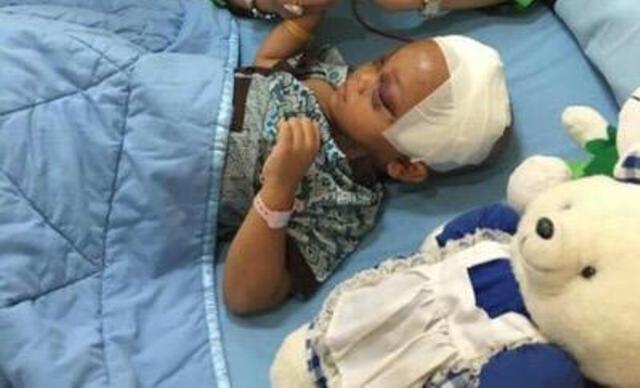 Usai Operasi di RSUP Adam Malik, Kinara Kembali Dipindah ke RS Bhayangkara