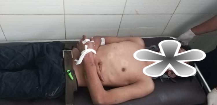 Terduga Maling Motor Tewas Dihajar Massa di Pelajar Timur 