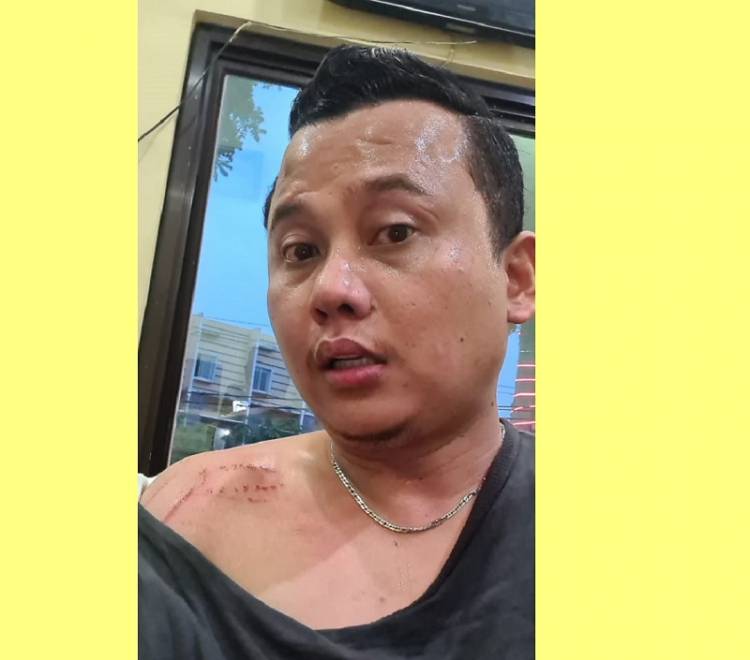 Korban Penganiayaan di Komplek Tasbih Medan Desak Polisi Tangkap Pelaku