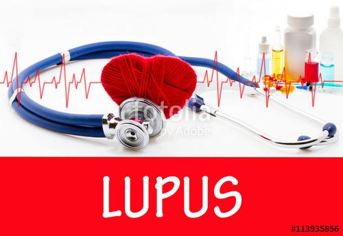 Lupus, Penyakit yang Bisa Mengenai Hampir Semua Organ Tubuh