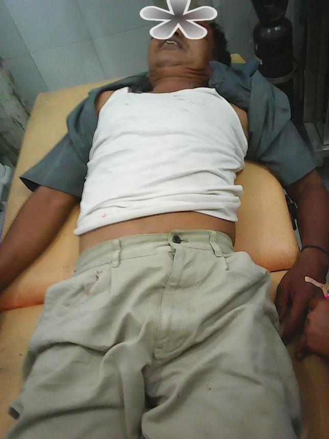 Tabrak Lari di Jalinsum Medan-Tebing Tinggi, Pengendara Honda Fit Kritis