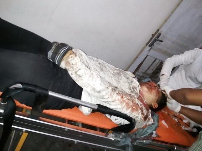 Tabrak Lari di Tanjung Morawa, Pengendara Honda Scoppy Tewas