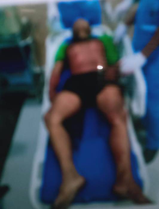Becaknya Tak Selesai Diperbaiki, Saat Ditagih, Tukang Becak Ini Malah Dibunuh di Johor