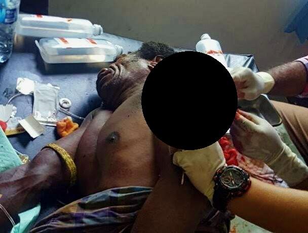 Gara-gara BBM, Yakobes Dianiaya Hingga Robek Lengan Kiri