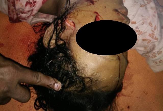 Kejam, Hamil 7 Bulan, Br Ginting Dibunuh Suami di Pancurbatu