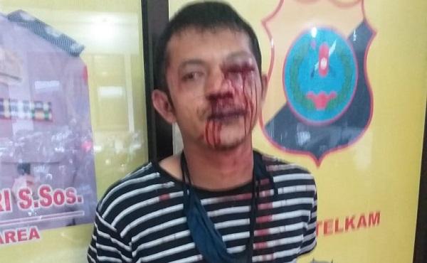 Curi Motor di Denai, Rudi Hartono Berdarah-darah Dihajar Warga