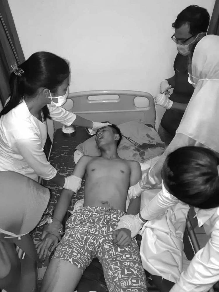 Geng Motor Lempari Remaja Pengendara Motor Hingga Kepala Pecah Saat Melintas dekat Terminal Amplas Medan