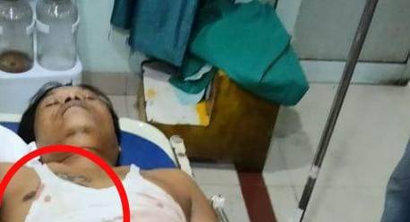 Perkumpulan Pemred Simalungun-Siantar Kutuk dan Desak Polisi Ungkap Penembakan Wartawan di Simalungun 