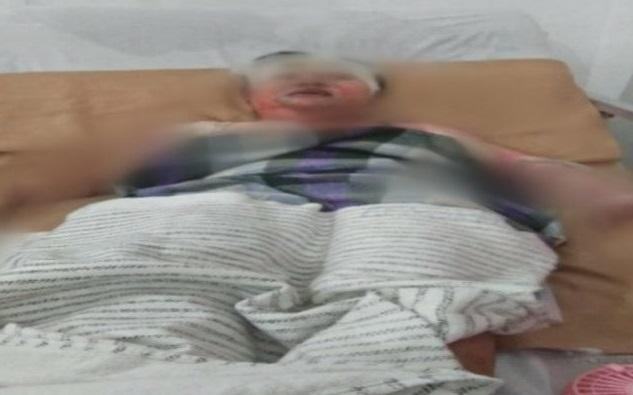 Pembakar Istri Sendiri di Cafe Ditangkap Polres Binjai