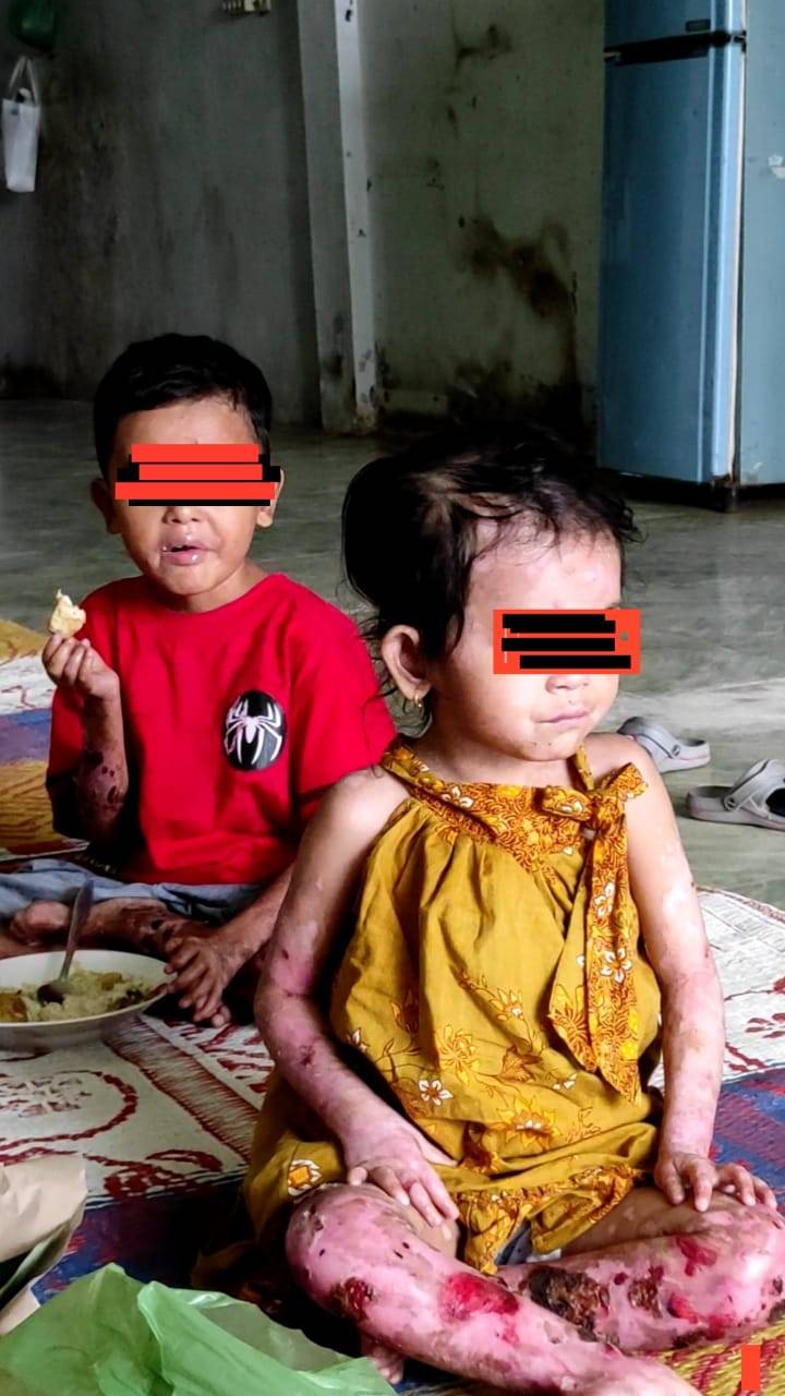 Jenguk Abang Beradik Penderita Penyakit Langka, Edy Rahmayadi Rujuk Haikal dan Zakira ke RS Haji Medan