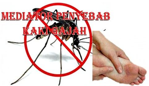 Kabupaten Asahan Tempati Peringkat Tertinggi Penderita Kaki Gajah di Sumut