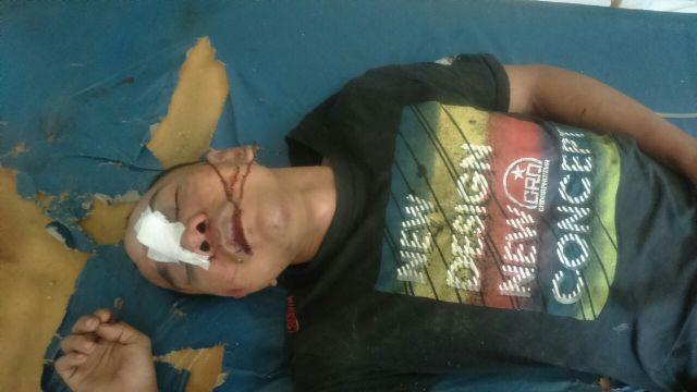 Jambret HP Mahasiswi di Depan Kampus UISU, Pria Ini Babak Belur Dihajar Warga