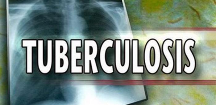 Atasi Tuberculosis, Pemerintah Bakal Laksanakan RAD di Seluruh Indonesia