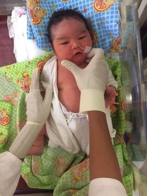 Ibu Suka Minum Es, Bayi 5,1 Kg Lahir di Hari Sumpah Pemuda