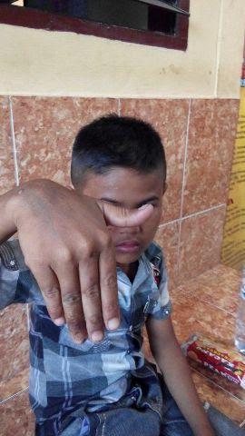 Tak Makan dan Tak Minum, Barus Dibuang Ayah Kandung dan Ibu Tiri di Fly Over Amplas