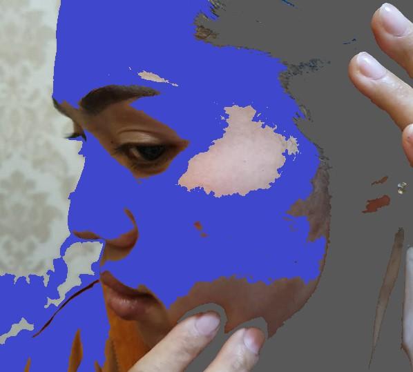 Ibu Hamil 5 Bulan Dihajar Tetangga Hingga Babak Belur di Helvetia