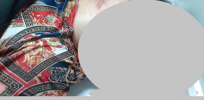 Diseruduk Truk, Rahmi Tewas di Jalan AH Nasution Depan Kantor PNPM Medan