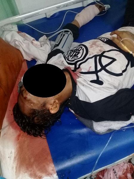 Tabrak Truk di Jalan Yos Sudarso Labuhan, Pergelangan Tangan Kiri Wahyu Kurniawan Patah