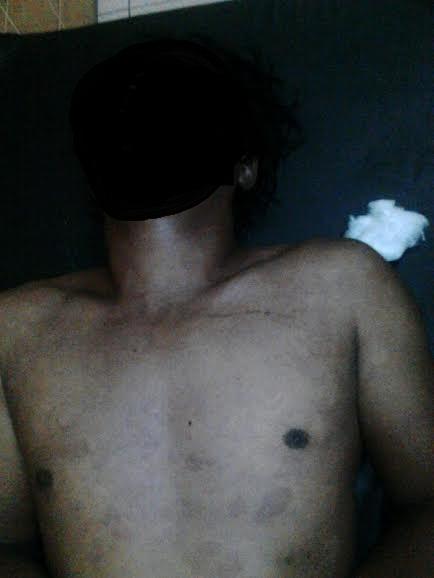 Kolam Renang Milik Pemkab Deli Serdang 'Makan' Dua Korban