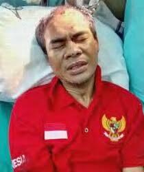 Ambil Dompet Perawat RS Murni Teguh, Indra Babak Belur Dihajar