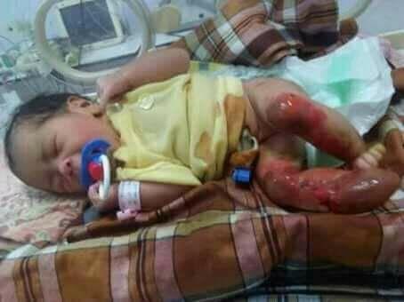 Idap Kanker Sel Darah, Keluarga Bayi Sakira Nasution Galang Dana Pengobatan