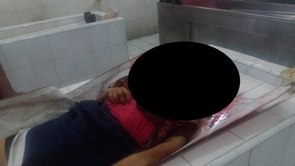 Seorang Mahasiswi Unimed Meninggal Usai Ditabrak Ibu-ibu yang Lagi Belajar Mobil di Komplek MMTC Pancing