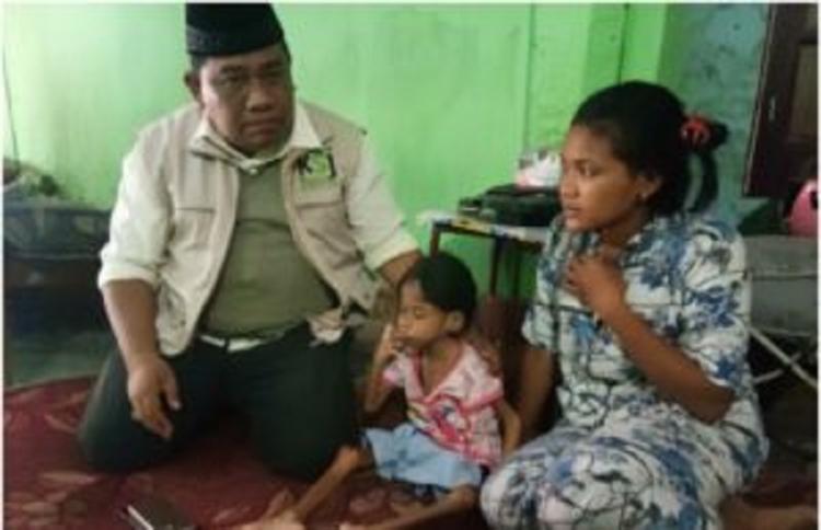 Kapolres Belawan Bantu Perobatan Bocah 8 Tahun Penderita Gizi Buruk
