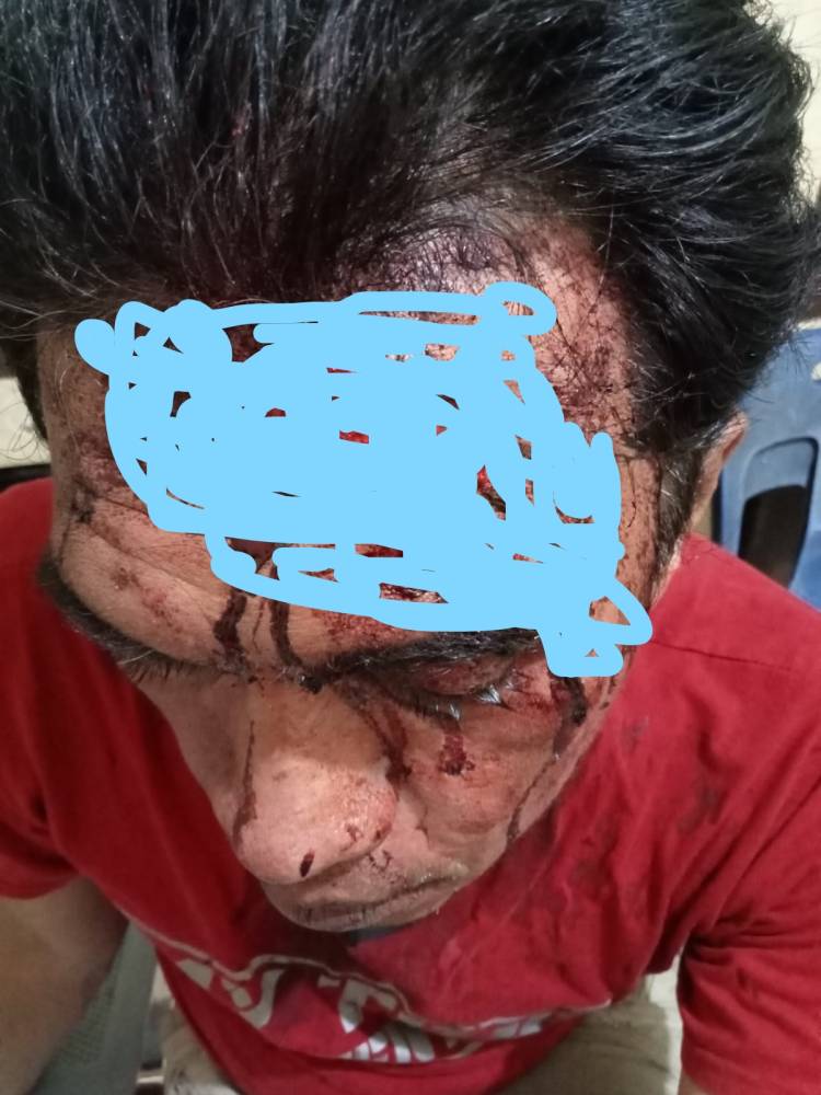Kepala Bocor Enam Jahitan Dihantam Batu Koral, BY Lapor ke Polsek Medan Area 