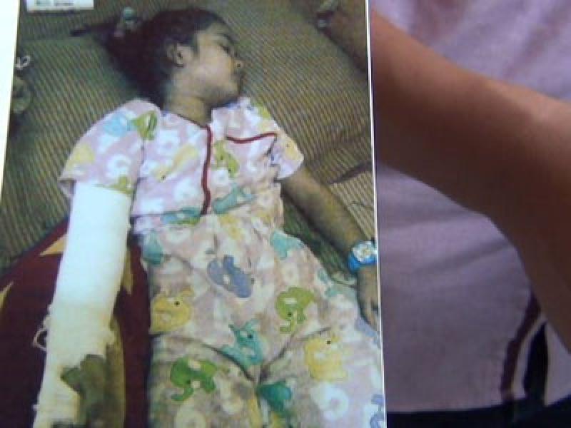 Bocah 5 Tahun Disiksa Ibu Kandung di Medan