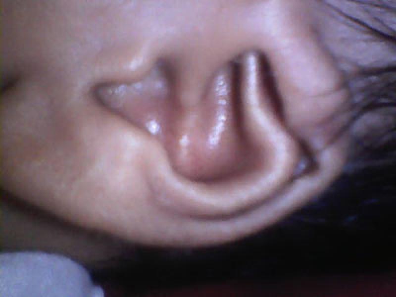 Telinga Bayi di Medan Berlafaz Allah