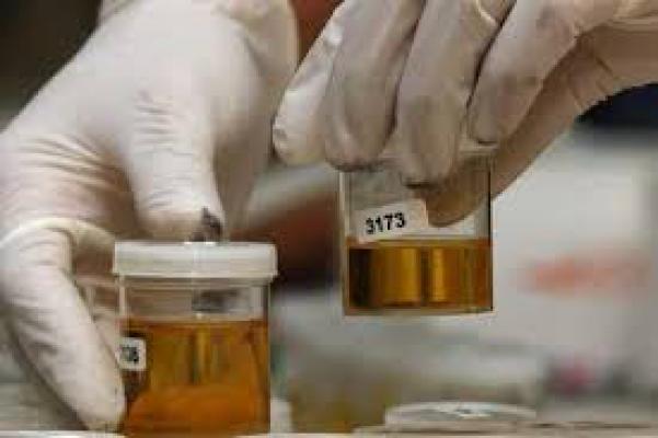 Anggota Polres Deli Serdang Dites Urine