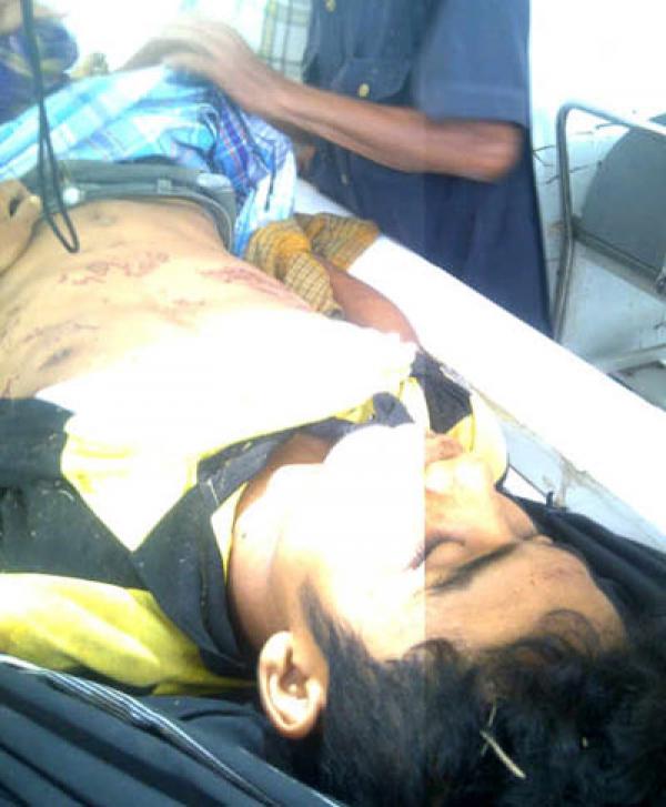 Pencari Emas Tewas Tertimpa Kayu di Madina